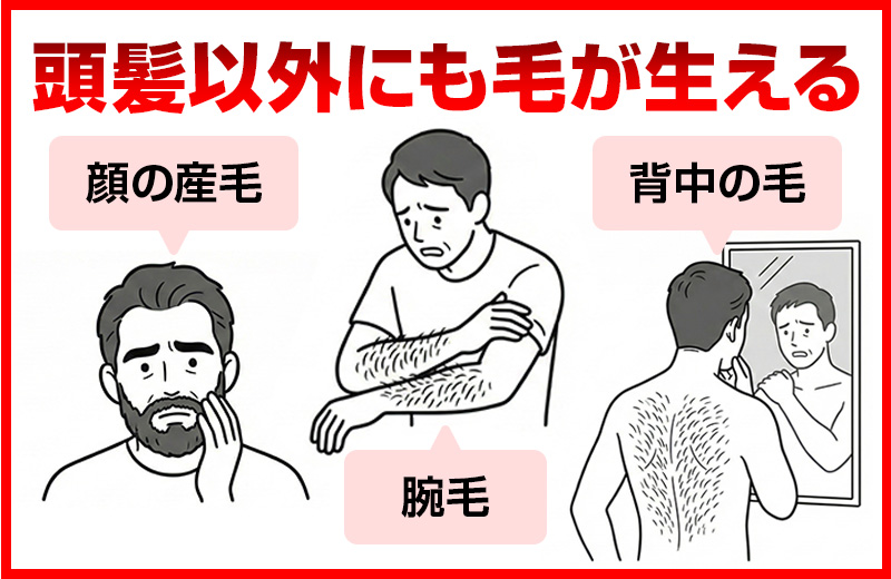 頭髪以外にも毛が生える。顔の産毛/腕毛/背中の毛